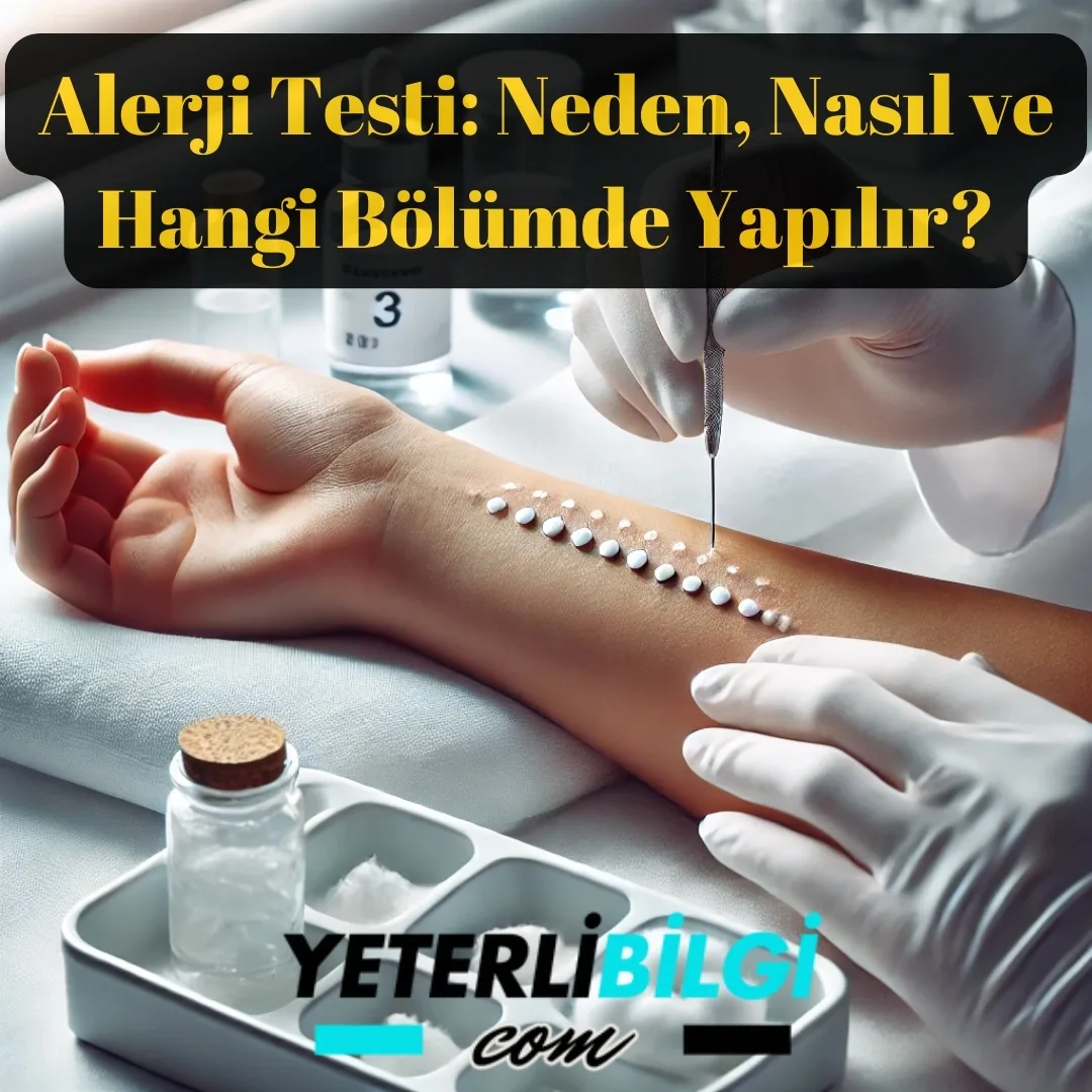 Alerji Testi Neden, Nasıl ve Hangi Bölümde Yapılır