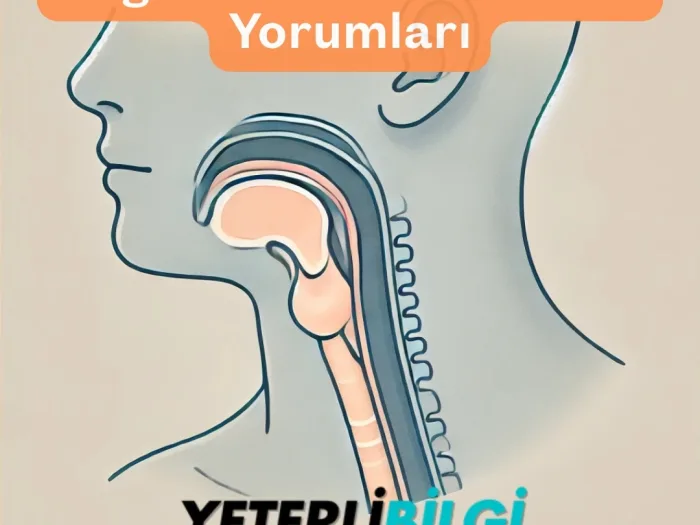 Boğaz Reflüsü Olanların Yorumları