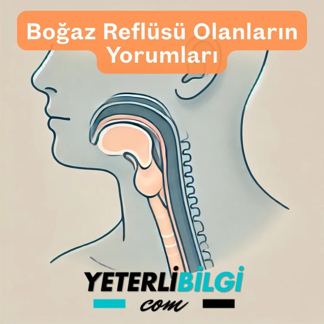 Boğaz Reflüsü Olanların Yorumları