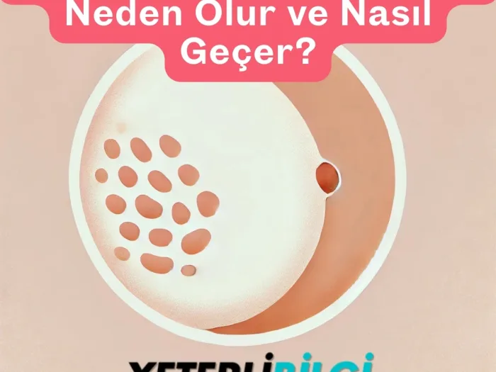 Göğüs Ucu Kabuklanması Neden Olur ve Nasıl Geçer