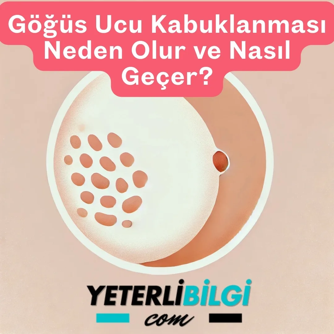 Göğüs Ucu Kabuklanması Neden Olur ve Nasıl Geçer