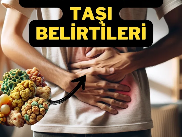 Safra Kesesi Taşı Belirtileri